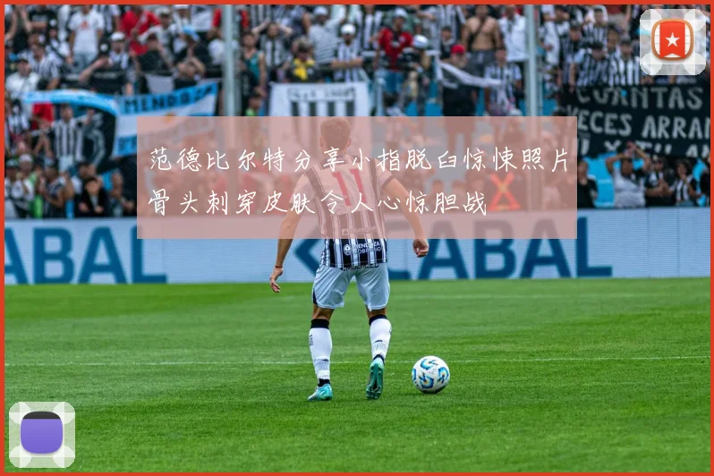 范德比尔特分享小指脱臼惊悚照片骨头刺穿皮肤令人心惊胆战
